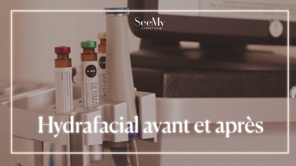 Hydrafacial avant et après