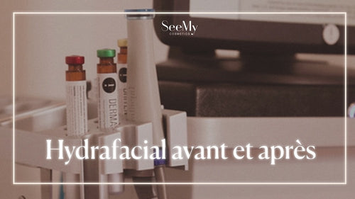 Hydrafacial avant et après