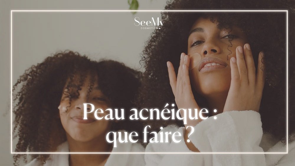 Peau acnéique : que faire ?