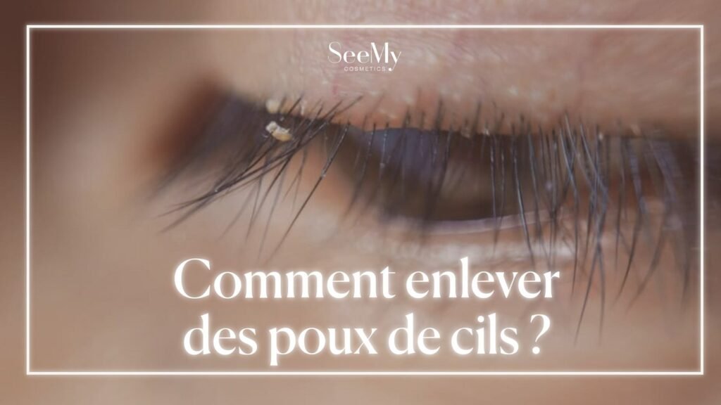 enlever_des_poux_de_cils