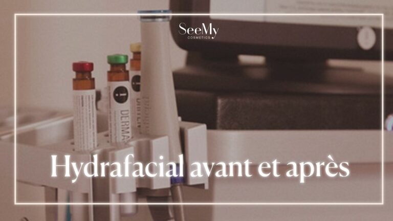 Hydrafacial avant et après
