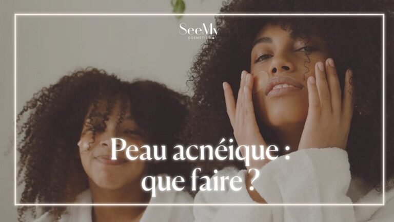 Peau acnéique : que faire ?