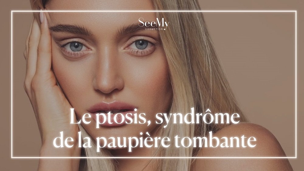 ptosis