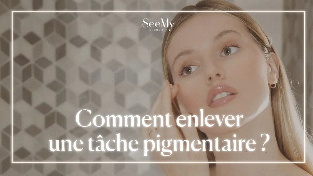 tache-pigmentaire