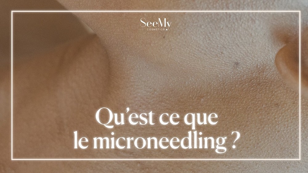 microneedling